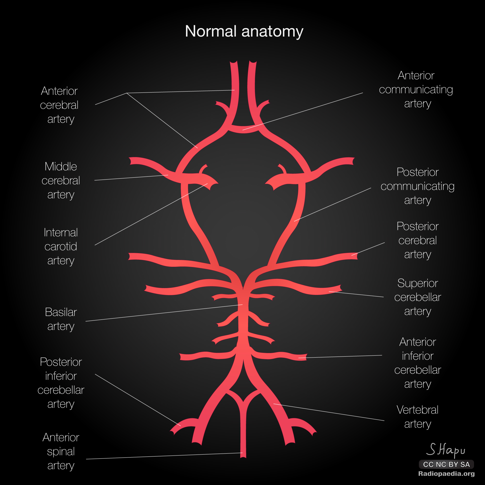 Radiopaedia Drawing Circle Of Willis English Labels Anatomytool 8289